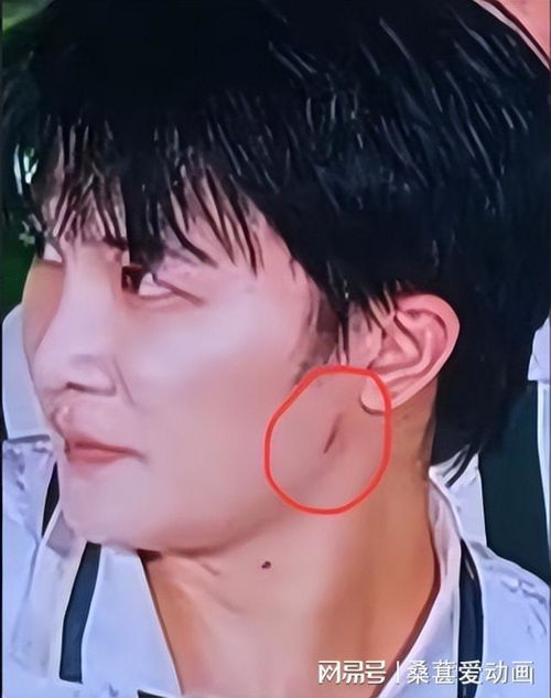 林俊杰的心脏:依赖药物 越来越差 林俊杰的心脏:依赖药物 越来越差