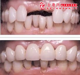 梦见拔牙齿是什么意思 周公解梦：解密，梦见拔牙齿是什么意思？周公解梦的智慧与现代解读