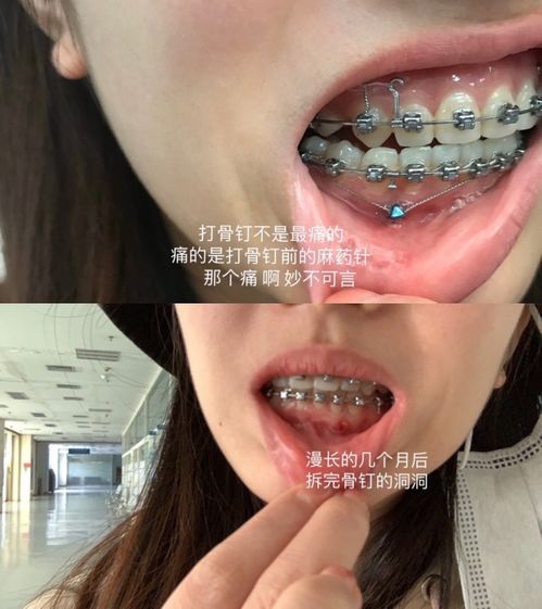 经常梦见掉牙：牙齿脱落的隐喻，解密经常梦见掉牙的心理密码