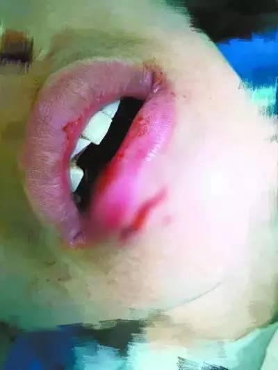 梦见掉门牙是什么征兆女人:梦见掉门牙,传统文化中的征兆与现代解读 梦见掉门牙是什么征兆女人:梦见掉门牙,传统文化中的征兆与现代解读