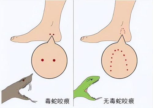 梦见自己被蛇咬伤出血什么预兆:梦见自己被蛇咬伤出血什么预兆? 梦见自己被蛇咬伤出血什么预兆:梦见自己被蛇咬伤出血什么预兆?