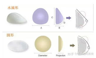 水滴形和圆形丰胸对比(水滴形和圆形丰胸对比真人) 水滴形和圆形丰胸对比(水滴形和圆形丰胸对比真人)