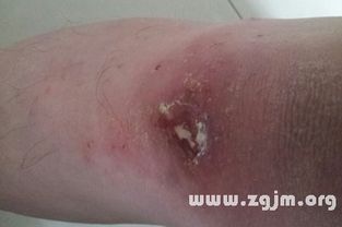 梦见蛆虫爬到身上是什么意思:解密梦境,梦见蛆虫爬到身上的隐喻与启示 梦见蛆虫爬到身上是什么意思:解密梦境,梦见蛆虫爬到身上的隐喻与启示