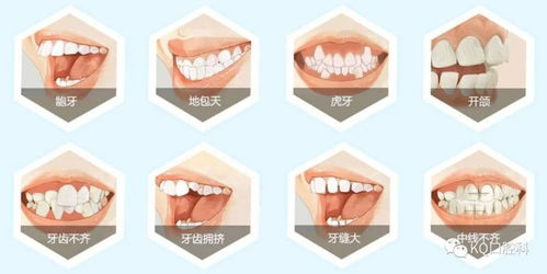 梦见掉牙齿的破解方法:梦见掉牙齿的破解方法,从心理到民俗的全面解析 梦见掉牙齿的破解方法:梦见掉牙齿的破解方法,从心理到民俗的全面解析