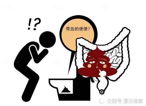拉屎出血:便血,可能是身体发出的危险信号 拉屎出血:便血,可能是身体发出的危险信号
