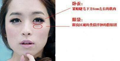 消除眼袋:告别眼袋,重拾明亮眼神,深入了解与解决方案 消除眼袋:告别眼袋,重拾明亮眼神,深入了解与解决方案