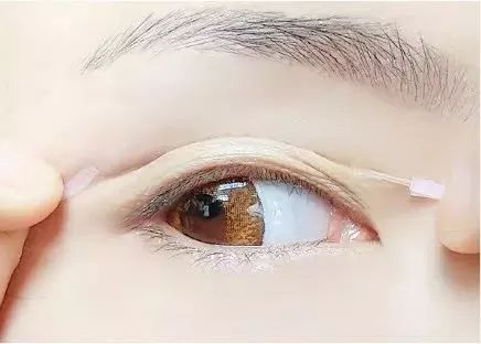 眼皮上面长了白点：眼皮上面长了白点？可能是这些原因！