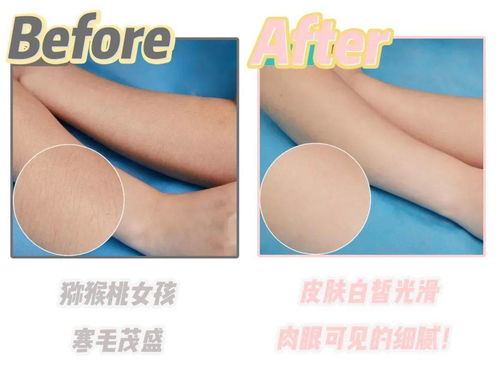 永久脱毛一般需要多少钱:永久脱毛到底要花多少钱?详细解析影响价格的关键因素 永久脱毛一般需要多少钱:永久脱毛到底要花多少钱?详细解析影响价格的关键因素