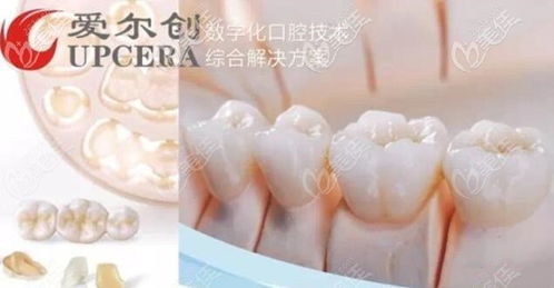 爱尔创全瓷牙800元：惊爆！爱尔创全瓷牙800元？这可能是你今年最大的牙齿美容捡漏机会！