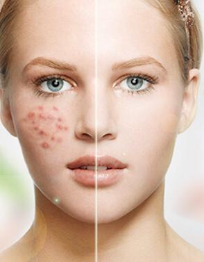 雀斑彻底根治的小偏方:天然温和告别顽固雀斑?这些小偏方或可助你焕亮肌肤! 雀斑彻底根治的小偏方:天然温和告别顽固雀斑?这些小偏方或可助你焕亮肌肤!