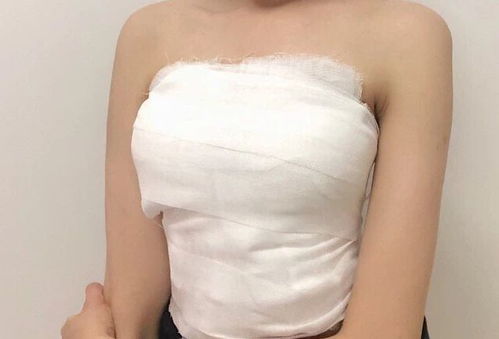 丰胸怎么做的手术过程:揭秘,丰胸手术全过程是怎样的?安全与效果如何保障?详细解析 丰胸怎么做的手术过程:揭秘,丰胸手术全过程是怎样的?安全与效果如何保障?详细解析