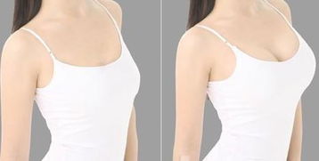 丰胸怎么做的手术过程:揭秘,丰胸手术全过程是怎样的?安全与效果如何保障?详细解析 丰胸怎么做的手术过程:揭秘,丰胸手术全过程是怎样的?安全与效果如何保障?详细解析