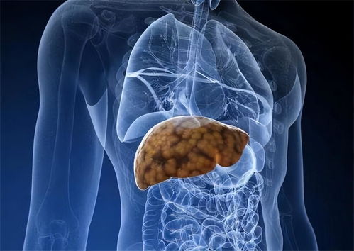 肝脏不好有哪些症状：肝脏在默默提醒你？这些信号别忽视！