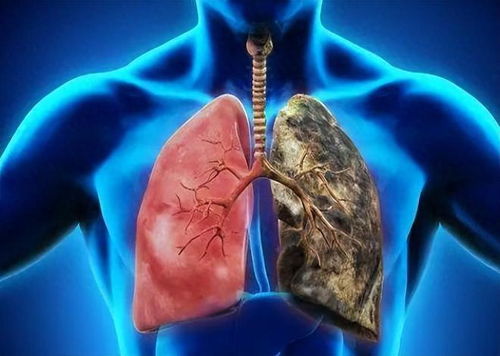 什么原因会怀上葡萄胎:葡萄胎的成因解析,了解这一妊娠异常的原因 什么原因会怀上葡萄胎:葡萄胎的成因解析,了解这一妊娠异常的原因