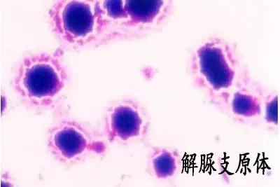 什么原因会怀上葡萄胎:葡萄胎的成因解析,了解这一妊娠异常的原因 什么原因会怀上葡萄胎:葡萄胎的成因解析,了解这一妊娠异常的原因