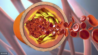 十种溶血栓最强的中药:最强溶栓中药,十种疏通血管、溶解血栓的中药推荐 十种溶血栓最强的中药:最强溶栓中药,十种疏通血管、溶解血栓的中药推荐
