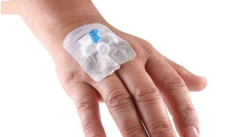 修复耳神经的药有哪些:修复耳神经的药物有哪些?这些药物或可帮助改善耳部健康 修复耳神经的药有哪些:修复耳神经的药物有哪些?这些药物或可帮助改善耳部健康