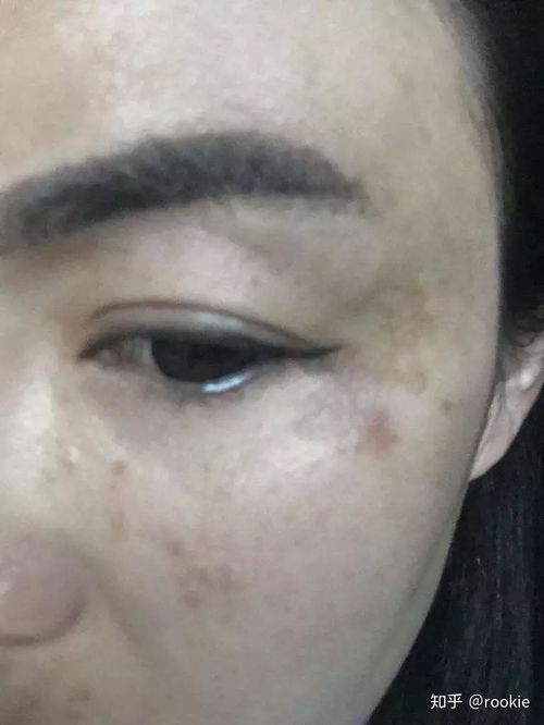 怎么才能去掉老年斑:老年斑困扰?这些方法帮你有效去除,重焕肌肤光采! 怎么才能去掉老年斑:老年斑困扰?这些方法帮你有效去除,重焕肌肤光采!