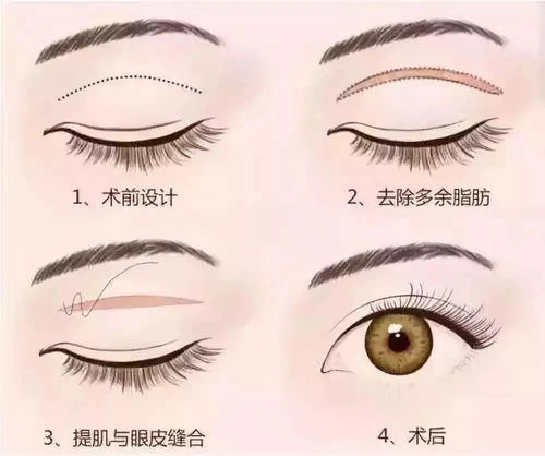 眼睛变大简单小妙招：瞬间睁大双眼！这些简单小妙招让你的眼睛哇变大