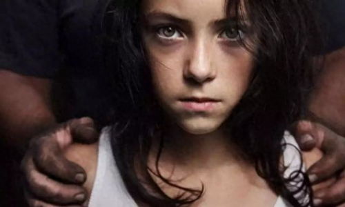 50岁手背上长斑的原因:50岁手背长斑,是衰老还是健康警报?揭秘背后的原因 50岁手背上长斑的原因:50岁手背长斑,是衰老还是健康警报?揭秘背后的原因