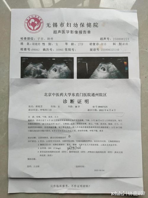 hcg多少是怀孕了:HCG多少是怀孕了?科学解读妊娠早期指标 hcg多少是怀孕了:HCG多少是怀孕了?科学解读妊娠早期指标