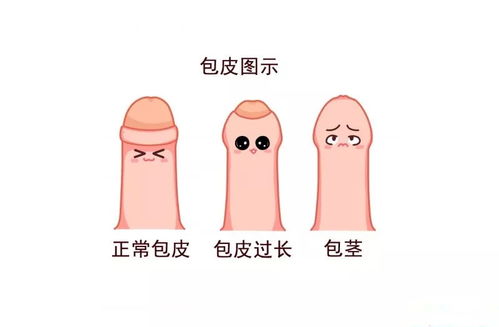 25岁割包茎是不是晚了:25岁割包茎,真的晚了吗?揭开包茎矫正的年龄迷思 25岁割包茎是不是晚了:25岁割包茎,真的晚了吗?揭开包茎矫正的年龄迷思