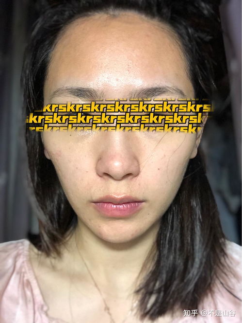 内调去暗黄最有效的方法:彻底告别暗沉黄气脸!最有效的内调去黄方法大公开 内调去暗黄最有效的方法:彻底告别暗沉黄气脸!最有效的内调去黄方法大公开