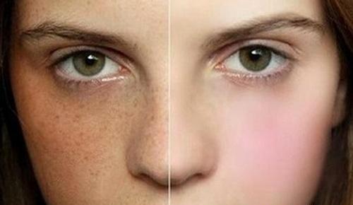 色斑怎么去除掉:彻底告别烦人色斑,这些方法你一定要知道! 色斑怎么去除掉:彻底告别烦人色斑,这些方法你一定要知道!