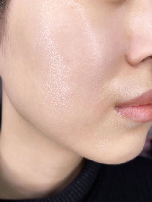 脸有红血丝怎么修复:脸有红血丝怎么修复?全面指南,从根源改善红血丝困扰 脸有红血丝怎么修复:脸有红血丝怎么修复?全面指南,从根源改善红血丝困扰