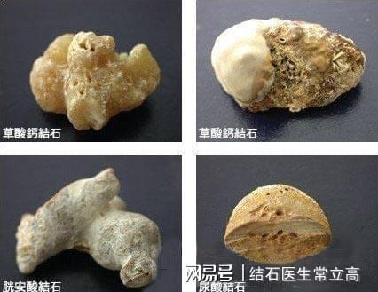 吃槟榔的危害:槟榔真的没危害?这些真相你一定要知道! 吃槟榔的危害:槟榔真的没危害?这些真相你一定要知道!