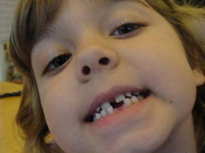 梦见自己牙齿掉光了是什么意思:解密梦境,梦见自己牙齿掉光了是什么意思? 梦见自己牙齿掉光了是什么意思:解密梦境,梦见自己牙齿掉光了是什么意思?