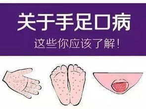 手足口病会传染大人么:手足口病会传染大人么? 手足口病会传染大人么:手足口病会传染大人么?