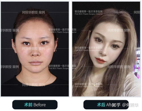 颧骨高是什么样子的脸图片:颧骨高是什么样子的脸图片?高颧骨脸型的特征与适合的妆容、发型全解析 颧骨高是什么样子的脸图片:颧骨高是什么样子的脸图片?高颧骨脸型的特征与适合的妆容、发型全解析