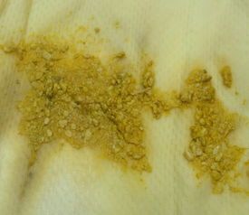 梦见屎是什么预兆女性：女性梦见排泄物，解析梦中秽物的隐喻与预兆