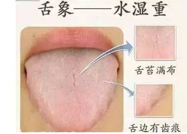 正常人上火的舌头图片:警惕!这些舌象变化可能是身体上火的信号,正常人该如何应对? 正常人上火的舌头图片:警惕!这些舌象变化可能是身体上火的信号,正常人该如何应对?