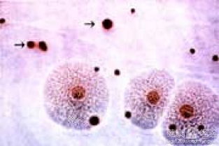 解脲支原体是怎么感染上的:解脲支原体感染,了解它的传播途径与预防措施 解脲支原体是怎么感染上的:解脲支原体感染,了解它的传播途径与预防措施