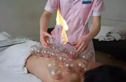 小心刮痧拔火罐害了你:警惕!刮痧拔火罐可能致命,这些隐藏风险你必须知道! 小心刮痧拔火罐害了你:警惕!刮痧拔火罐可能致命,这些隐藏风险你必须知道!