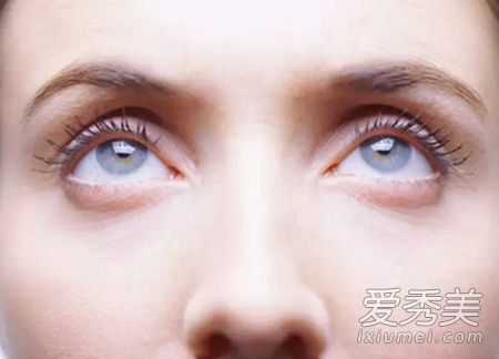 怎样去除眼角纹最有效:告别岁月痕迹!这5种方法是去除眼角纹最有效的秘密武器 怎样去除眼角纹最有效:告别岁月痕迹!这5种方法是去除眼角纹最有效的秘密武器