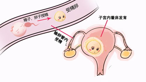 妇科炎症可以自愈吗:妇科炎症真的可以自愈吗? 妇科炎症可以自愈吗:妇科炎症真的可以自愈吗?