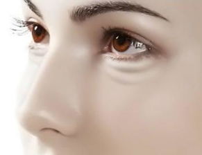 黑眼圈是怎么形成的：为什么你的眼下总是有黑眼圈？揭秘黑眼圈形成的多种原因