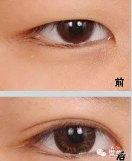 左上眼皮跳是凶是吉：左上眼皮跳是凶是吉？传统文化与现代科学的科学解读