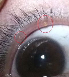 左上眼皮跳是凶是吉：左上眼皮跳是凶是吉？传统文化与现代科学的科学解读