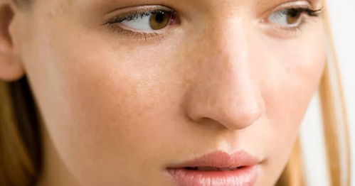 黄褐斑是什么原因造成的：黄褐斑是什么原因造成的？揭开斑点背后的真相