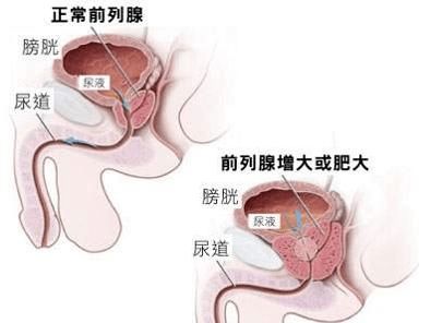 泌尿外科看男性功能吗：泌尿外科看男性功能吗？答案在这里！