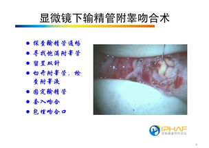 泌尿外科看男性功能吗：泌尿外科看男性功能吗？答案在这里！