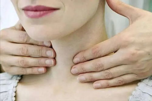 甲状腺肿大能消下去吗：甲状腺肿大能消下去吗？原因、治疗与预后全解析