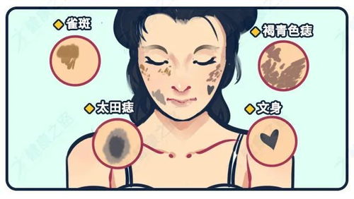 皮肤科医生推荐:皮肤困扰?皮肤科医生如何明智选择?专业推荐与选择指南 皮肤科医生推荐:皮肤困扰?皮肤科医生如何明智选择?专业推荐与选择指南