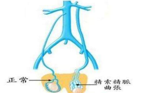 精子活力30%可以怀孕吗：精子活力30%可以怀孕吗？权威解析生育能力评估标准