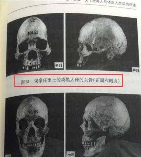梦见人头骨:颅骨低语,梦境与潜意识的神秘对话 梦见人头骨:颅骨低语,梦境与潜意识的神秘对话