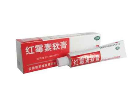 过敏了能用红霉素软膏吗:过敏了能用红霉素软膏吗?你需要知道的几点关键信息 过敏了能用红霉素软膏吗:过敏了能用红霉素软膏吗?你需要知道的几点关键信息